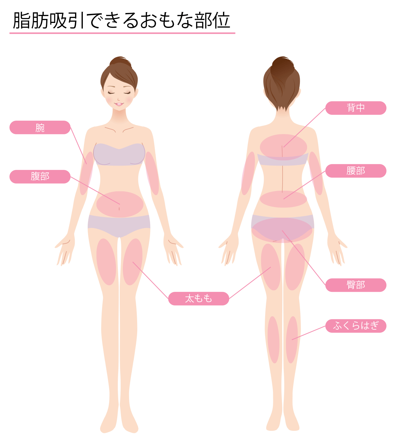 脂肪吸引できるおもな部位